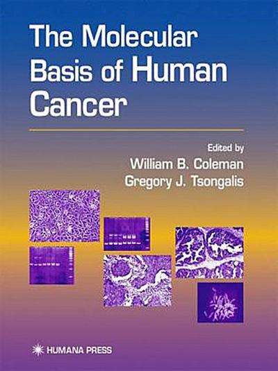The Molecular Basis of Human Cancer