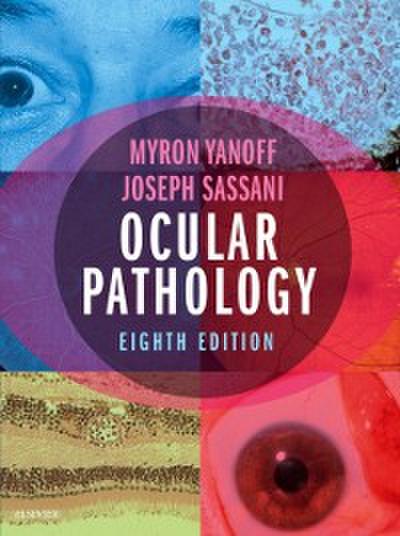 Ocular Pathology