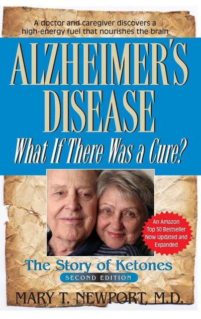 Alzheimer’s Disease
