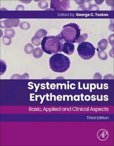 Systemic Lupus Erythematosus