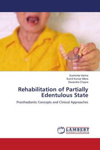 Rehabilitation of Partially Edentulous State