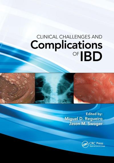 Clinical Challenges and Complications of IBD