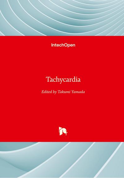 Tachycardia