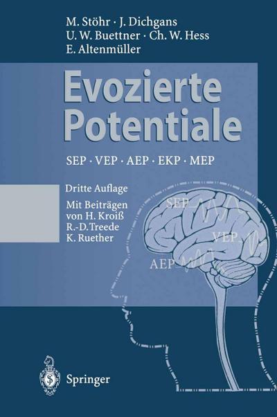 Evozierte Potentiale