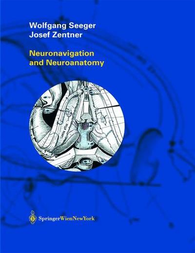 Neuronavigation and Neuroanatomy