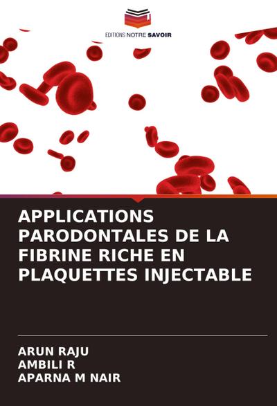 APPLICATIONS PARODONTALES DE LA FIBRINE RICHE EN PLAQUETTES INJECTABLE