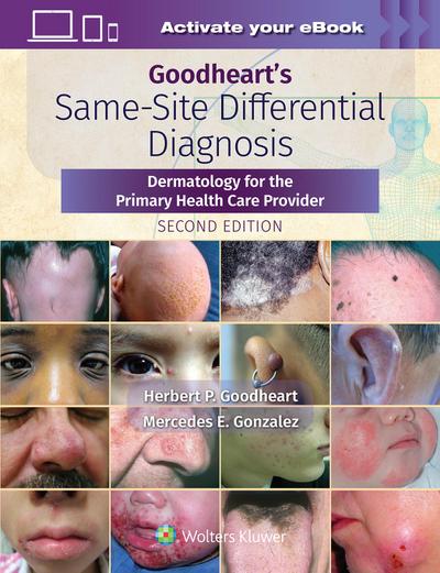 Goodheart’s Same-Site Differential Diagnosis