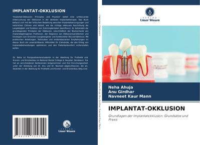 IMPLANTAT-OKKLUSION