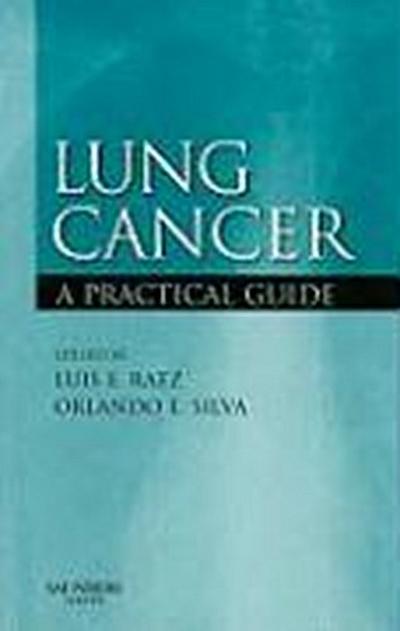 Lung Cancer: A Practical Guide