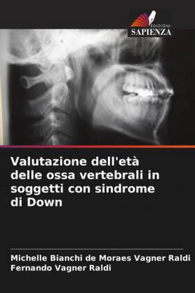 Valutazione dell’età delle ossa vertebrali in soggetti con sindrome di Down