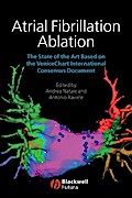 Atrial Fibrillation Ablation