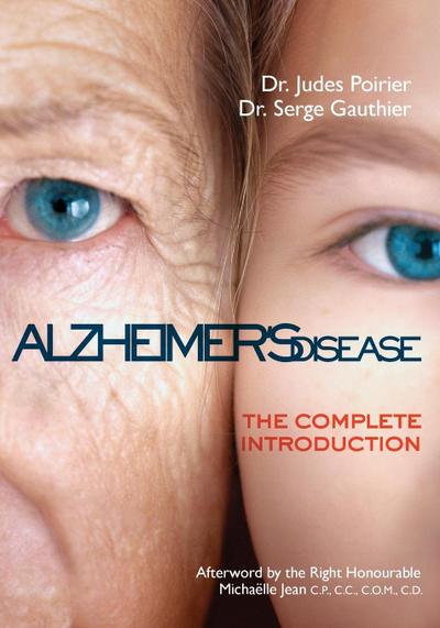Alzheimer’s Disease