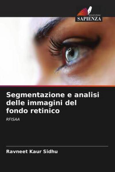 Segmentazione e analisi delle immagini del fondo retinico