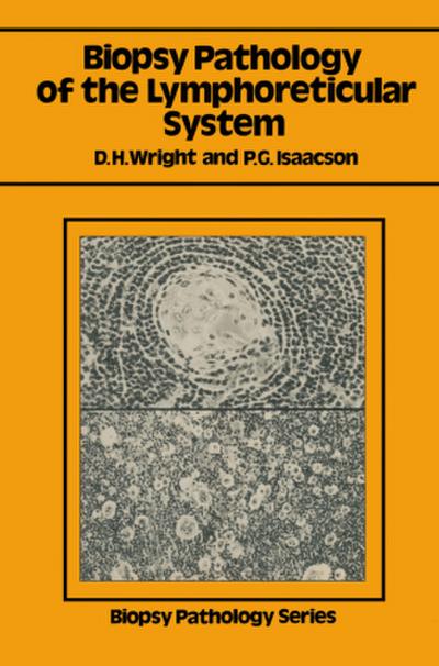 Biopsy Pathology of the Lymphoreticular System