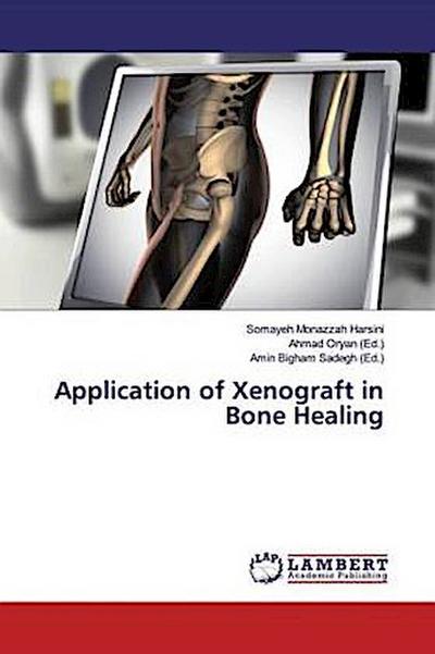 Application of Xenograft in Bone Healing