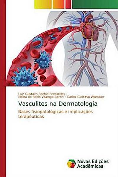 Vasculites na Dermatologia