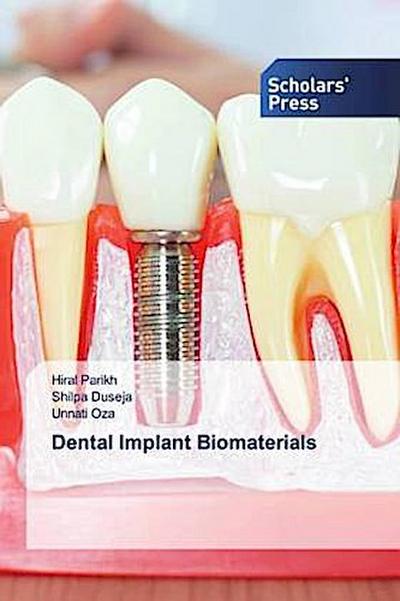 Dental Implant Biomaterials