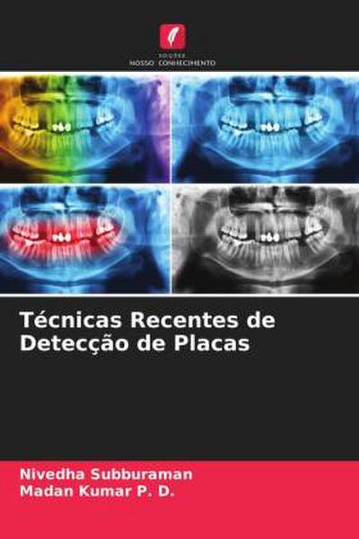Técnicas Recentes de Detecção de Placas