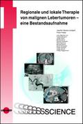 Regionale und lokale Therapie von malignen Lebertumoren - eine Bestandsaufnahme