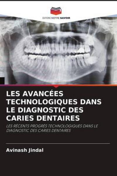 LES AVANCÉES TECHNOLOGIQUES DANS LE DIAGNOSTIC DES CARIES DENTAIRES