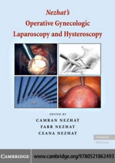 Nezhat’s Operative Gynecologic Laparoscopy and Hysteroscopy