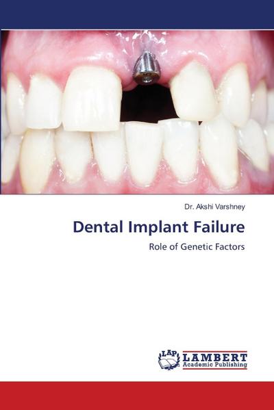Dental Implant Failure