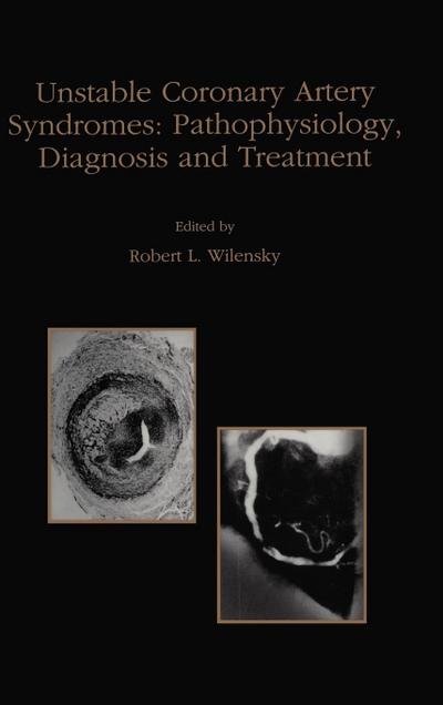 Unstable Coronary Artery Syndromes Pathophysiology, Diagnosis and Treatment