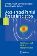 Accelerated Partial Breast Irradiation