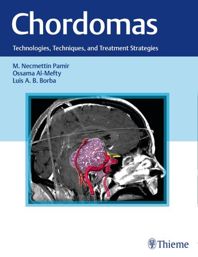 Chordomas