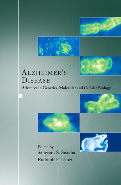 Alzheimer’s Disease
