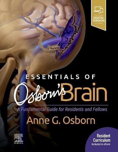 Essentials of Osborn’s Brain
