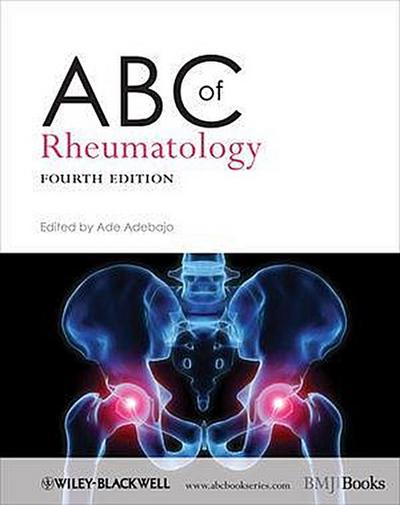 ABC of Rheumatology
