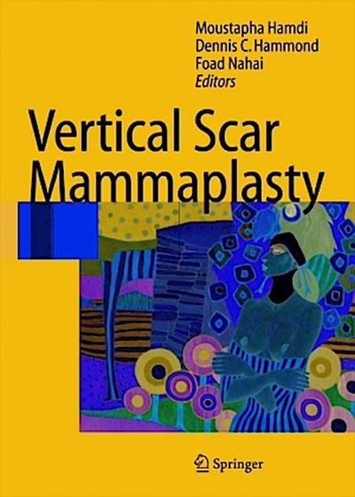 Vertical Scar Mammaplasty