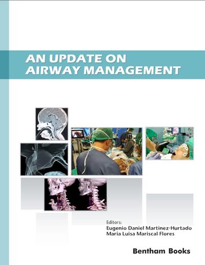An Update on Airway Management
