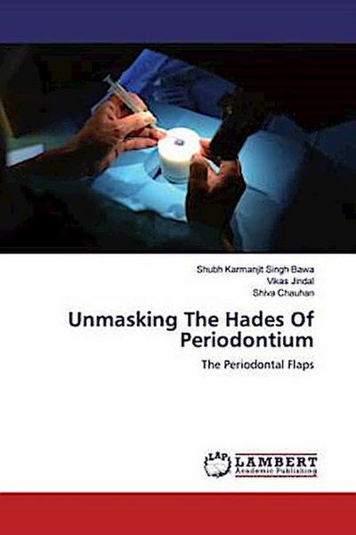 Unmasking The Hades Of Periodontium
