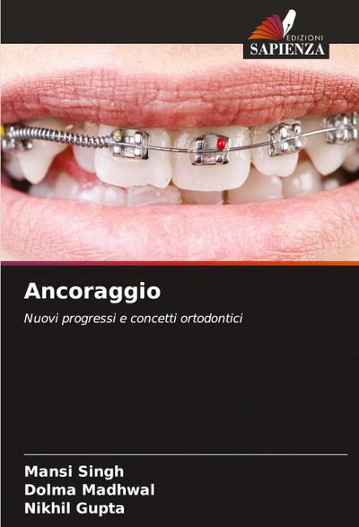 Ancoraggio