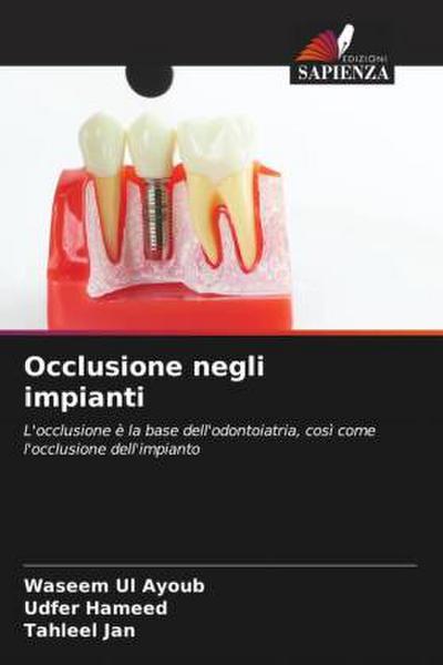 Occlusione negli impianti