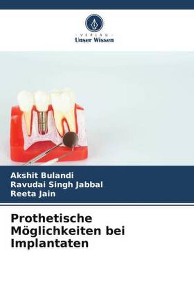 Prothetische Möglichkeiten bei Implantaten