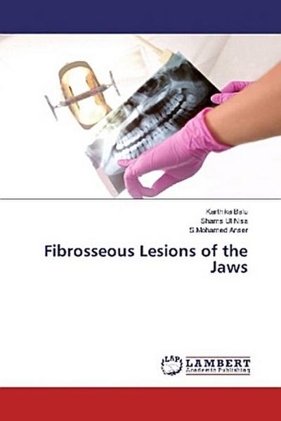 Fibrosseous Lesions of the Jaws