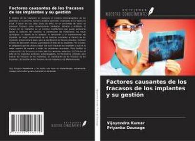 Factores causantes de los fracasos de los implantes y su gestión