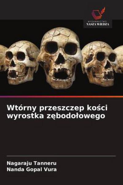Wtórny przeszczep ko¿ci wyrostka z¿bodo¿owego