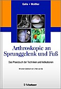 Arthroskopie an Sprunggelenk und Fuß: Das Praxisbuch der Techniken und Indikationen