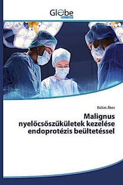 Malignus nyel¿cs¿sz¿kületek kezelése endoprotézis beültetéssel