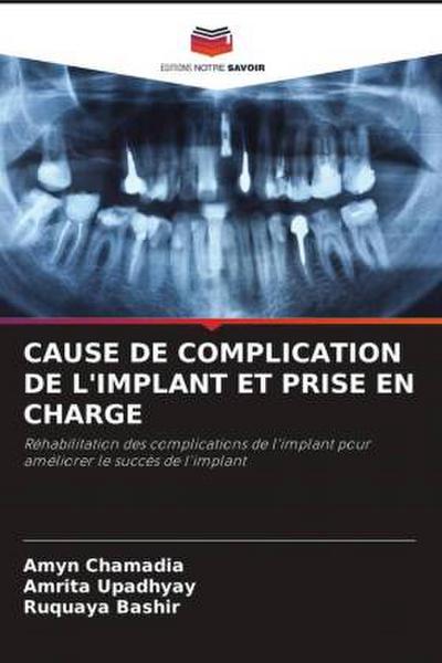 CAUSE DE COMPLICATION DE L’IMPLANT ET PRISE EN CHARGE