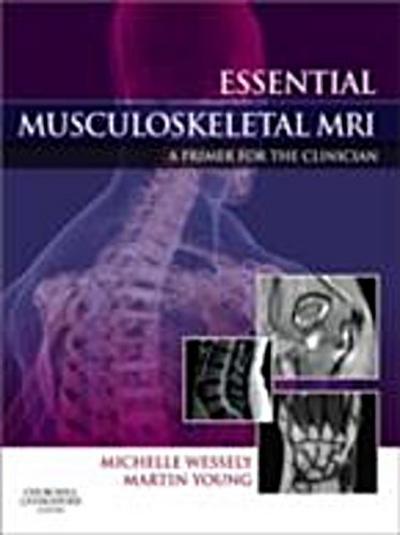 Essential Musculoskeletal MRI E-Book