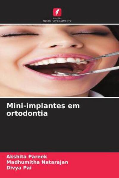 Mini-implantes em ortodontia