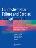 Congestive Heart Failure and Cardiac Transplantati