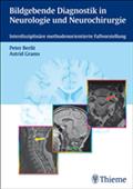 Bildgebende Diagnostik in Neurologie und Neurochirurgie von Peter-Dirk Berlit | Ebook