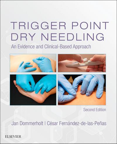 Trigger Point Dry Needling E-Book