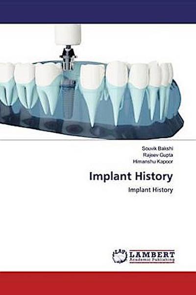 Implant History